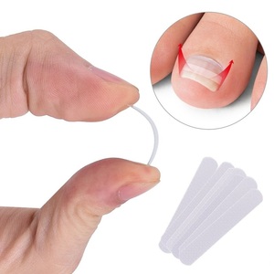 UpLac Ingrown Toenail Correction Strips 10 pcs